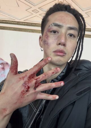 ▲▼ 《金特務》遭蘇志燮扯頭皮「整塊掉了」　男星雷鬼頭是真髮：全壞光。（圖／翻攝自裴志完IG）