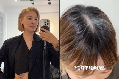 李懿動手術3個月禁染髮　掀髮驚見「大片白色」求救釣出一排苦主