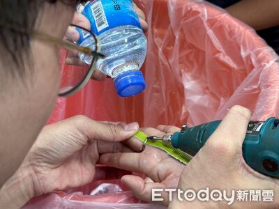 戒指卡手指缺血腫脹!花蓮消防員噴水降溫切割 驚險助脫困