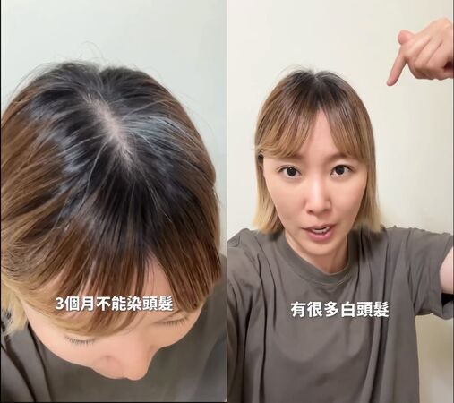 ▲▼李懿掀髮驚見「大片白色」求救釣出一排苦主。（圖／翻攝自Instagram／summer_lee_oh）