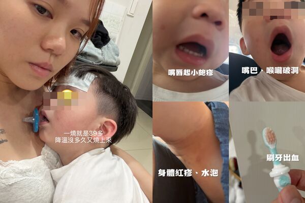 ▲▼陳彥婷2歲兒反覆高燒找不到病因「刷牙發現流血」。（圖／翻攝自Facebook／陳彥婷 Tiffany﻿）