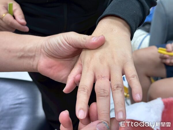 ▲▼消防員用切割機並持續噴水降溫順利取下戒指。（圖／花蓮消防局提供，下同）