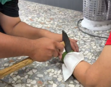 彰化婦車禍手腫如「麵龜」卡手環痛到崩潰!消防員神來一鎚救命