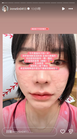 ▲▼艾融。（圖／翻攝自Instagram／irenelin0413）