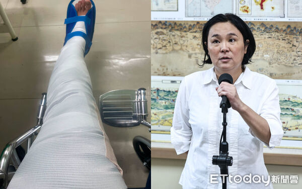 ▲陳玉珍今左小腿肌肉出問題，送醫打石膏。（合成圖／翻攝自臉書「陳玉珍 珍愛金門」、記者林敬旻攝）