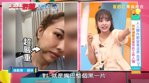▲▼徐凱希。（圖／翻攝自YouTube／醫師好辣）