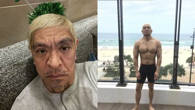 松本人志「血便不停」確診大腸癌! 暫裝人工肛門:以為自己快死了
