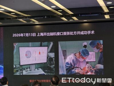 中國搶攻腦機介面!不須開顱、新技術血管植入最快只要10分鐘