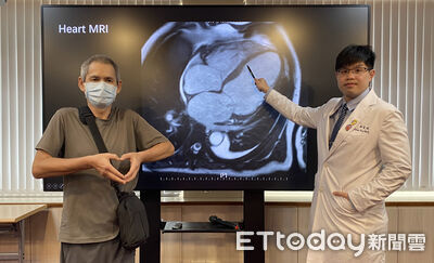 外送員「胸口像被大象踩」罕見血型難換心險死　人工心臟救命