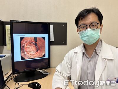 他左上腹悶痛半年「胃裡藏6公分基質瘤」 醫揭與胃癌差異