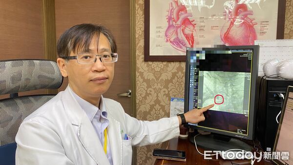 員榮醫療體系員榮醫院心臟外科主任賴金湖醫師解說，患者無名靜脈完全阻塞（圖中紅圈處）。（圖／員榮醫院提供）