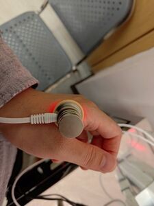 北榮桃園分院帶您認識「雷射針灸」　無痛治療新選擇