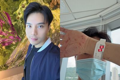 37歲男星遊法健行「突長紅疹吞嚥困難」! 急返港轉介住院