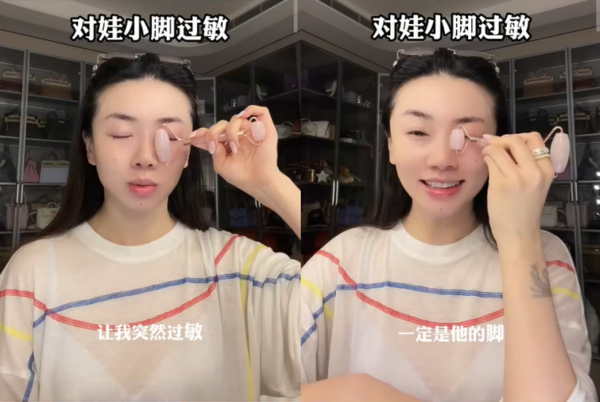 ▲▼700萬網紅吸嬰兒腳丫「臉過敏腫成豬頭」。（圖／翻攝自微博）