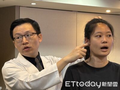 少女吃烤肉竟讓顳顎關節卡2年 長庚微創手術助恢復張口