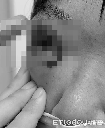 小六生折斷掃把打老師濺血！驚悚傷勢畫面曝　女師恐失明將提告