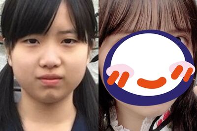 國一就整形!日本24歲前女偶像「驚人對比照」曝 砸130萬換臉