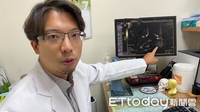 馬拉松男腳跟痛治不好 竟是「跟骨骨髓水腫」