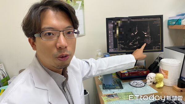 員榮醫療體系員榮醫院復健科陳冠霖主任，解說患者受傷部位（手指處）為跟骨內部。