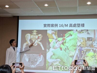 高中生5樓墜落休克　醫用「體內止血帶」爭取40分鐘救命