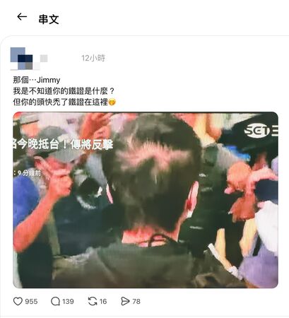 趙建銘薄情揭密／獨家！趙建銘一轉身「頭頂禿一大片」全見光　醫揭2大原因