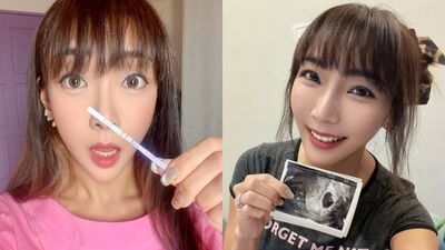 42歲自然懷第6胎! 資生堂千金曬超音波照:過世狗狗回來找我了