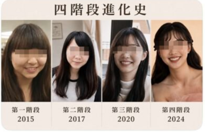 許芊芊2015年照曝光!4進化史吸36萬人朝聖 網驚呼:跟九妹有得比