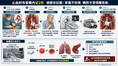 止血紗布留體內2年！男開刀發現14天後亡　心臟醫過失致死被起訴