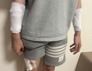遭口罩男持美工刀攻擊！苗栗護理師忍痛開車就醫　警鎖定嫌犯