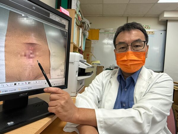 衛福部台中醫院一般外科醫師曾旭弘