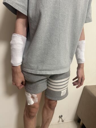 ▲苗栗高鐵特定區今凌晨發生歹徒持美工刀攻擊男護理師案,被害人懷疑可能跟病患糾紛有關,警方已鎖定兇嫌。(圖/記者楊永盛翻攝)