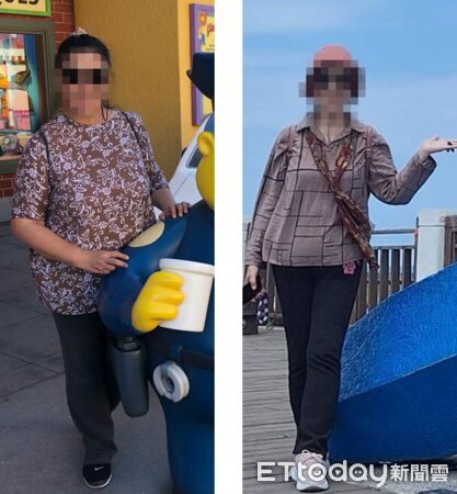 ▲▼     瘦身        。（圖／亞東醫院提供）