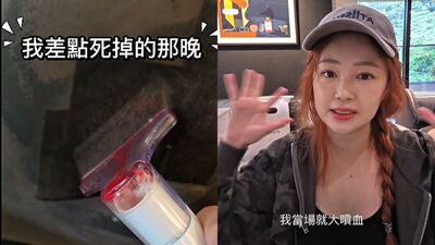 丫頭跌倒撞破頭慘縫5針! 「狂流7小時血」親還原驚悚過程
