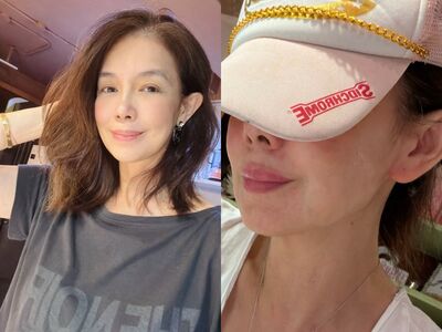 55歲林美貞突發「可怕身體狀況」！遮半臉近照曝：說不出的無力感