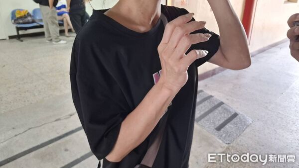 ▲台南市45歲李姓女子接受眼袋手術前施打麻醉，尚未動刀便出現呼吸困難，轉院搶救11天後不治，檢警相驗死者父母（左一、二）到場。（記者林東良翻攝，下同）