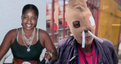 遭前夫潑酸毀容!女痛苦20多年獲准安樂死 突喊卡親曝下一步