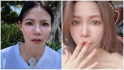 喉嚨癢到狂咳「真實病因竟不是感冒」！蘿莉塔傻眼：聽都沒聽過