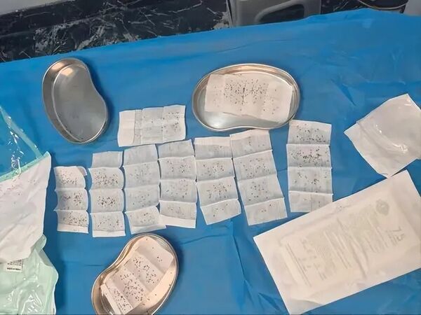 ▲▼医生拔出的毒刺。(图/翻摄洪观新闻)