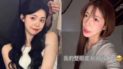 李多慧「雙眼皮消失」認想整形! PO文求解:要不要去割呢?