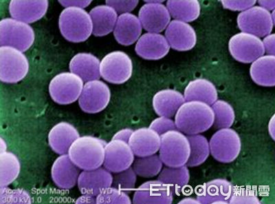 便當加熱再吃仍腹瀉 醫揭金黃色葡萄球菌「最易產毒溫度」