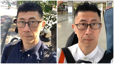 兩度視網膜剝離!台男星「再緊急動刀」:像在眼裡烤肉 術後近況曝