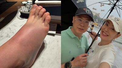 賈永婕曝尪「球場倒頭栽翻滾兩圈」 她氣到說不出話:豬隊友!