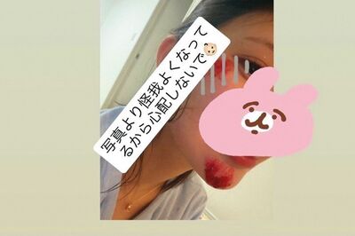 倉木華遭牛郎男友「打到毀容」悽慘傷照曝！　生前留求救信卻無人救援