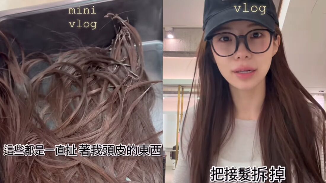 李多慧拍片「公開拆接髮過程」 親揭背後內幕：感覺我快禿頭了 | ETtoday星光雲 | ETtoday新聞雲