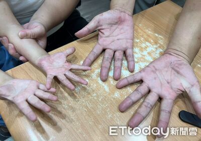 全身癢1個月!醫問「私密處也會癢吧」他愣住:全家接力傳染