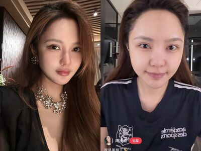 周揚青醫美後遺症現形！　認「臉腫饅化」素顏狀態曝光驚呆陸網