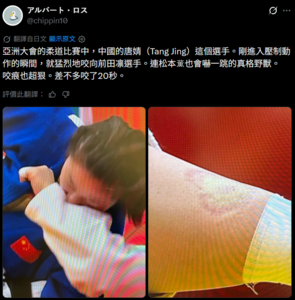 中國柔道女將咬人「齒痕照」曝光　陸網挺不下去