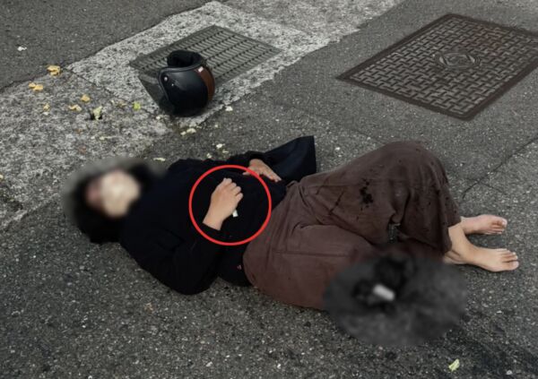 ▲斗六市發生轎車與機車碰撞事故,翁姓女騎士右腳骨折。(圖/民眾提供)
