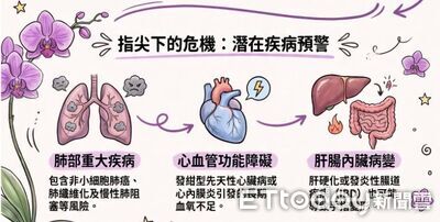 「手指變胖」恐是心肺病變警訊！醫揭3大特徵　快用食指自測