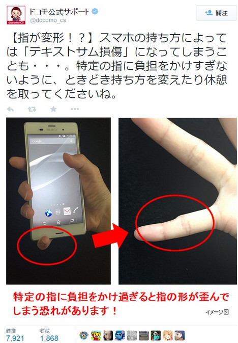 手機太大還是用得太久？日本傳小指變型案例